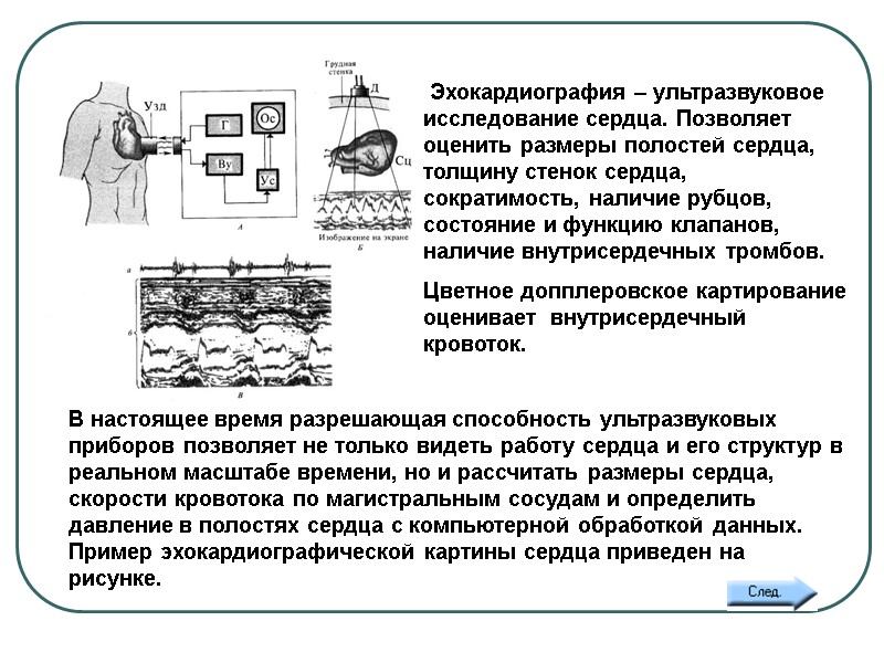 11а. ЭХОКАРДИОГРАФИЯ   Эхокардиография – ультразвуковое исследование сердца. Позволяет оценить размеры полостей сердца,